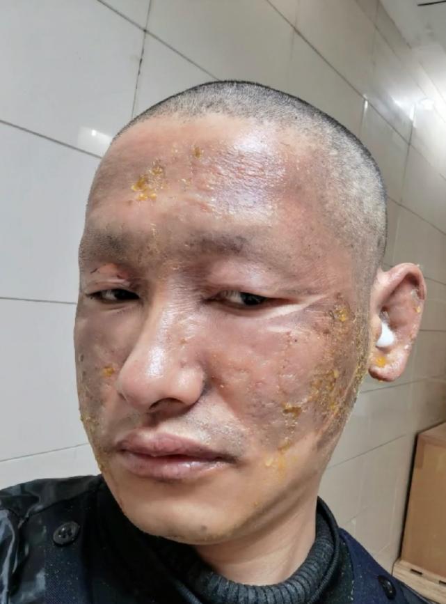 探索星光的奥秘，明星天脸重塑魅力的奇迹之旅